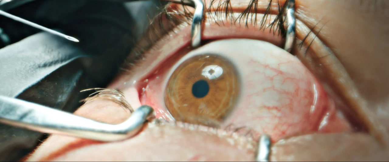  Дэвидсон заверил в интервью, что в сцене с уколом в глаз снимался без дублера