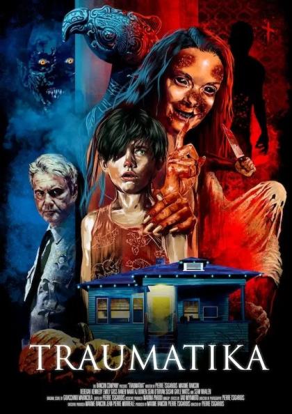 Травма
